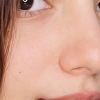 Dull, sun-tanned skin
