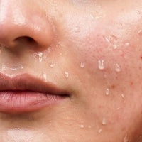 Dryness and tightness