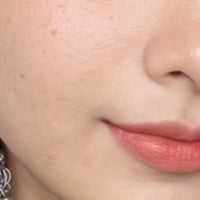 Marks from old breakouts