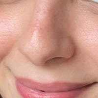 Pores that look large